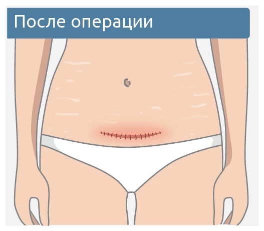Ресурс 8.png Ресурс 8.png